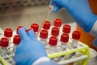 Koronaviruso tyrimai laboratorijoje 