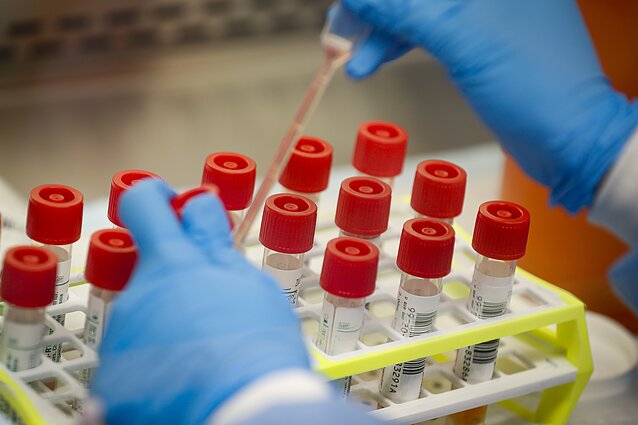 Koronaviruso tyrimai laboratorijoje 