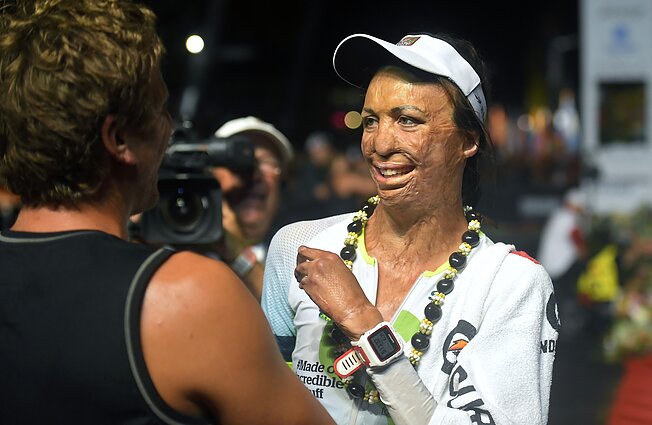 Turia Pitt