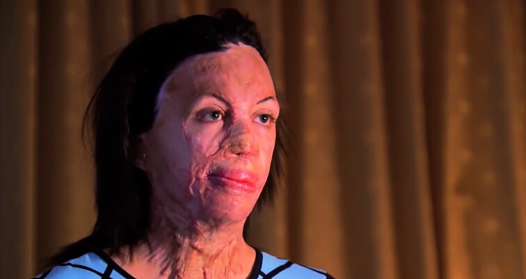 Turia Pitt