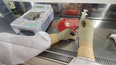 Santaros klinikose perversmą medicinoje sukelianti naujovė: kaip genetiškai pakeistos imuninės ląstelės kovoja su vėžiu Santaros klinikose perversmą medicinoje sukelianti naujovė: kaip genetiškai pakeistos imuninės ląstelės kovoja su vėžiu