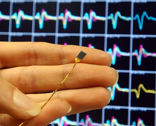Smegenų implantas, asociatyvi nuotr.
