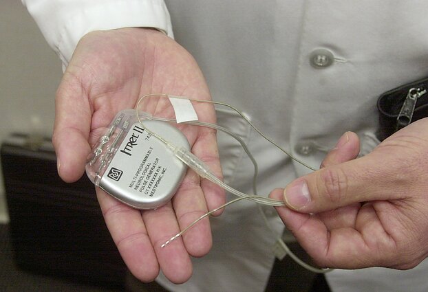 Smegenų implantas, asociatyvi nuotr.