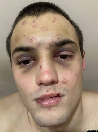 Artiomas Bykovas pasakojo, kad patyrė ypač žiaurų elgesį, kai jo vadai sužinojo, kad jis yra biseksualus