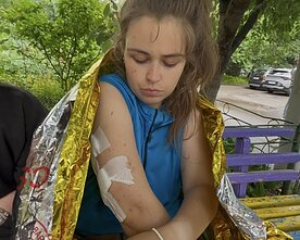 Stebuklingai išsigelbėjusi Oleksandra Kopycina rodė patirtus sužeidimus 