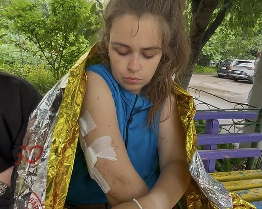 Stebuklingai išsigelbėjusi Oleksandra Kopycina rodė patirtus sužeidimus 